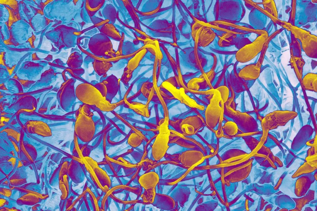 Can Lab-Grown Sperm Help Infertile Men Conceive Their Own Children?