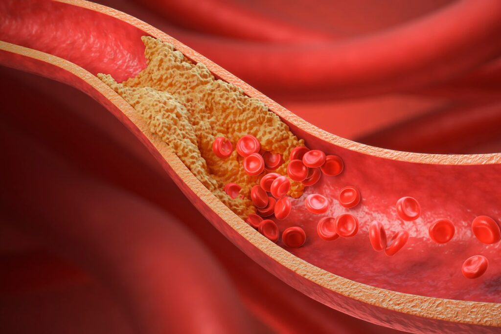 Discover Hidden Cholesterol-Lowering Supplements You Might Be Taking