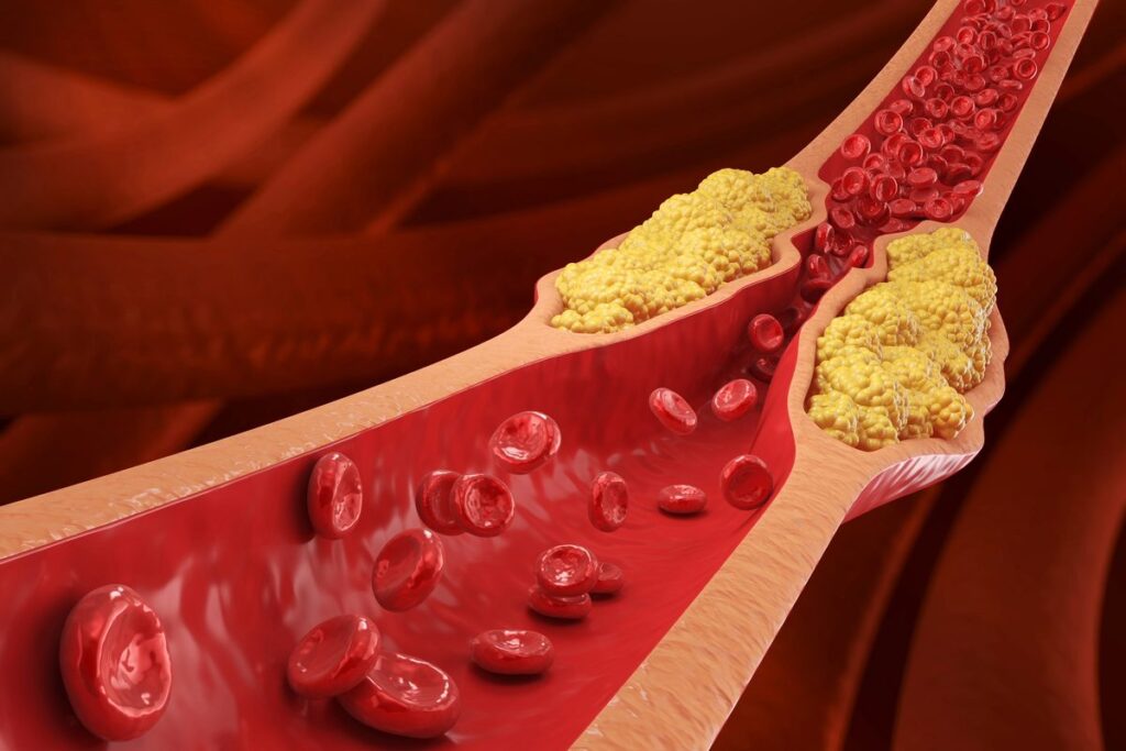 Discover the Countries with the Highest and Lowest Cholesterol Levels Worldwide