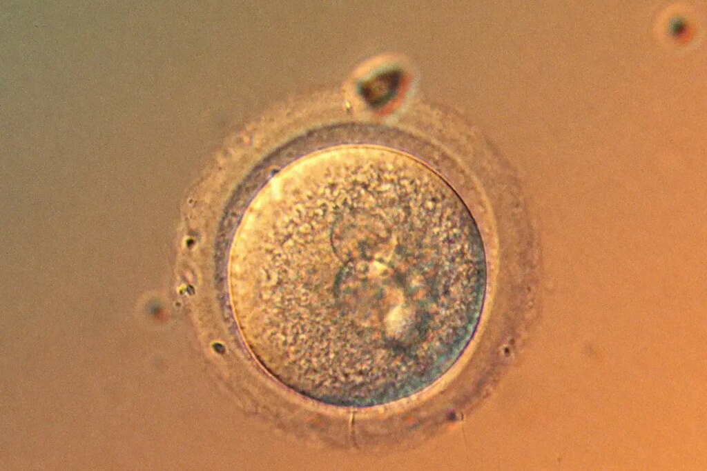 Is Gene Editing for Babies Now Safe? Current Insights and Considerations