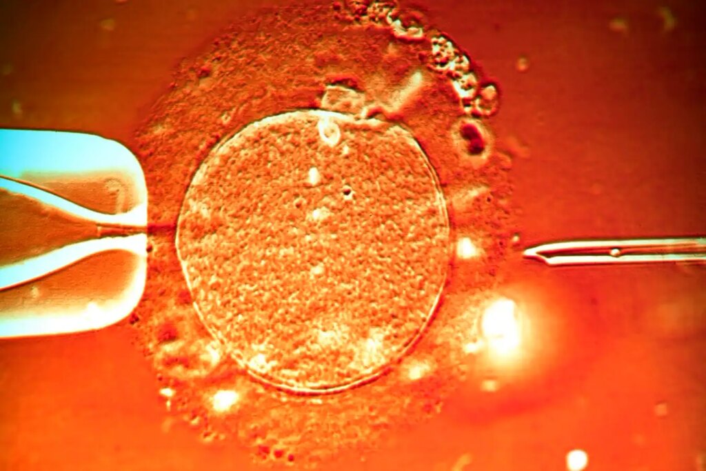 Magnetic Properties of Sperm: Enhancing In Vitro Fertilization Within the Body