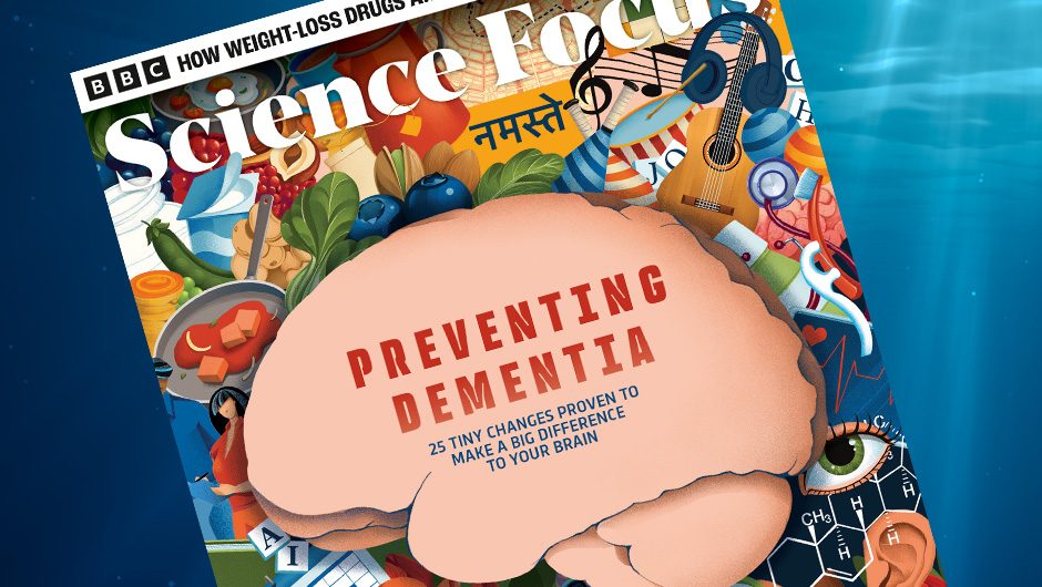 New Findings on Dementia Prevention | BBC Science Focus Magazine