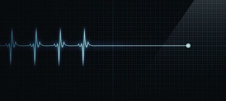 Understanding the Dying Process: Insights from Medical Experts on What Happens When We Die