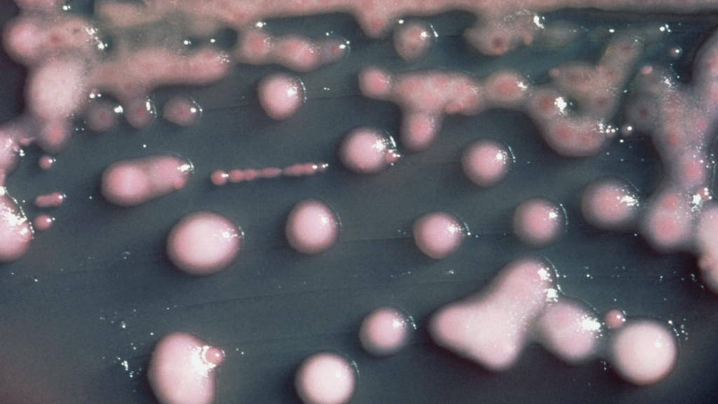 From Urinary Tract Infection to Brain Infection: The Evolution of Bacteria Over Two Years