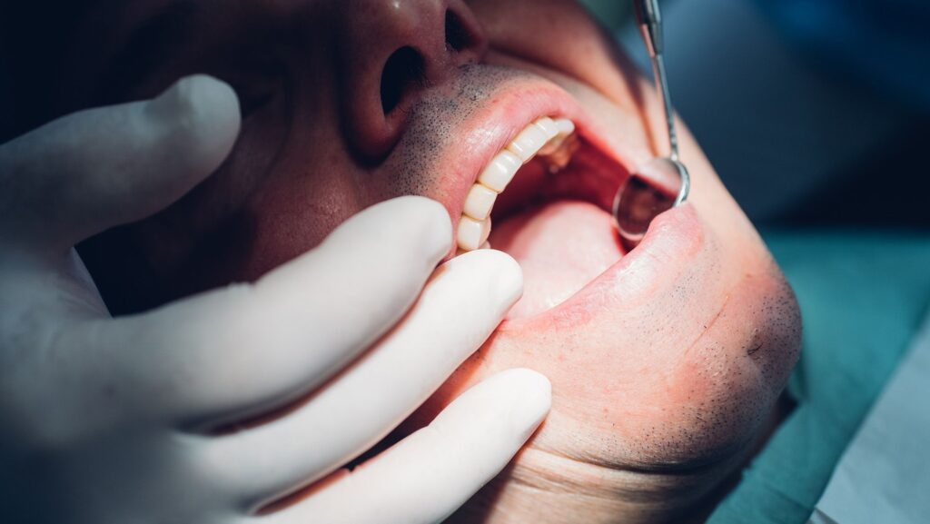 Scientists Uncover Potential Link Between Periodontal Disease and Heart Health Risks