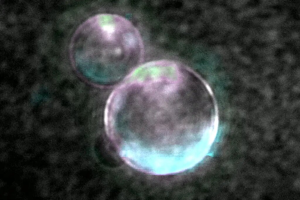 What Is a “Spud Cell”? Discover the Remarkable Breakthrough in Bioengineering