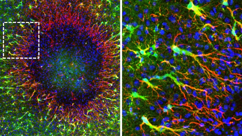 Adult Brain Repair: New Research Shows the Brain Can Heal Better Than Scientists Thought