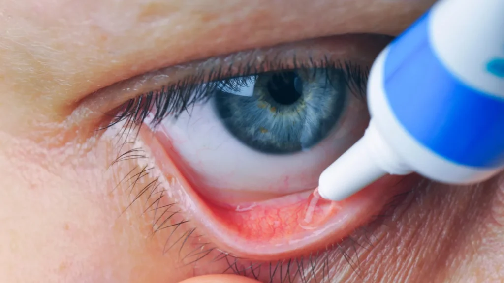 Experimental Eye Drops Restore Vision in Blind Mice, Study Finds