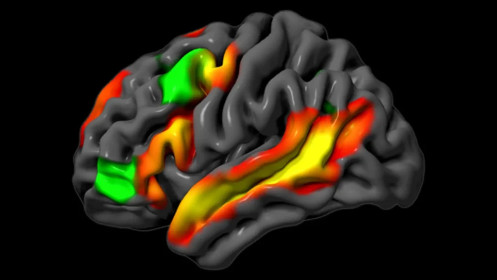 MIT Neuroscientists Discover How the Brain Reasons Without Words