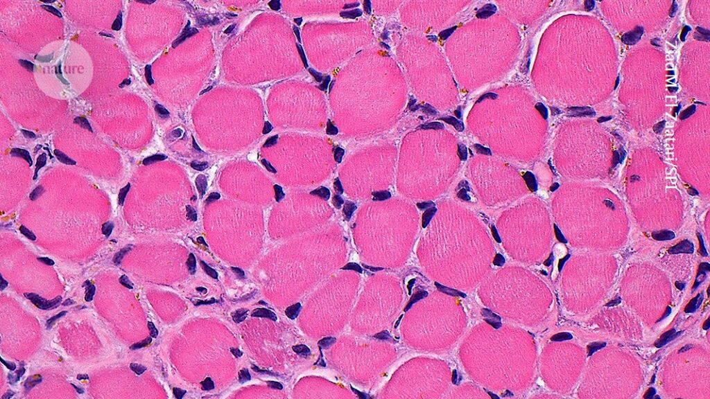 Pulsating Muscle Graft Mimics the Effects of Exercise