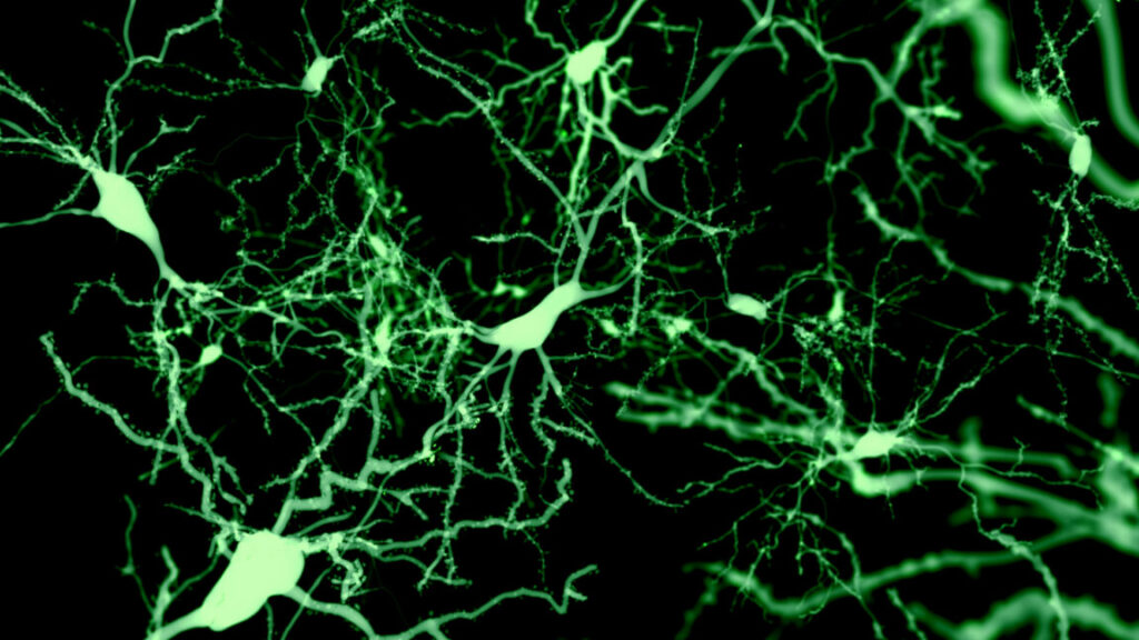 Brain Sleep Cells: Discover the Cells That Make Us Sleep