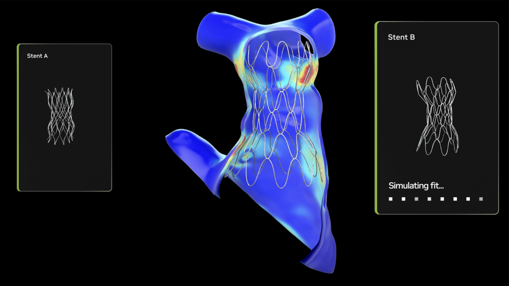 Children’s Hospital Uses Open-Source NVIDIA AI to Improve Cardiac Care