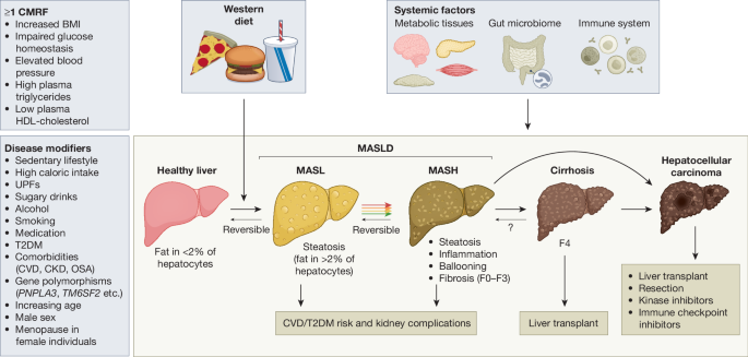 MASH: Molecular Mechanisms and Pathogenesis