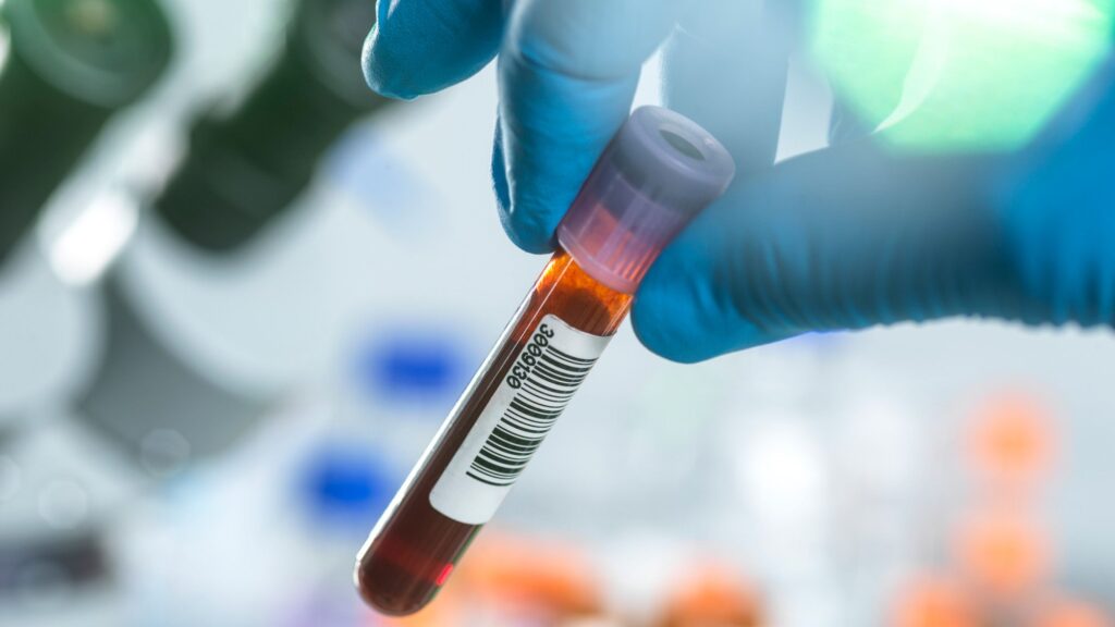 How Immune System Aging Affects Longevity and Healthy Lifespans
