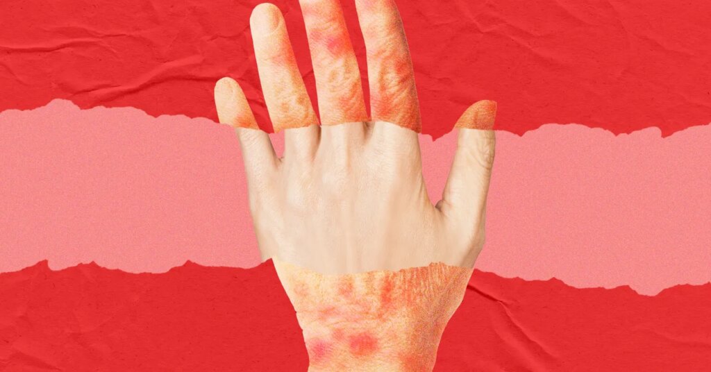 New Anti-Aging Drug Shows Promise in Reversing Skin Aging