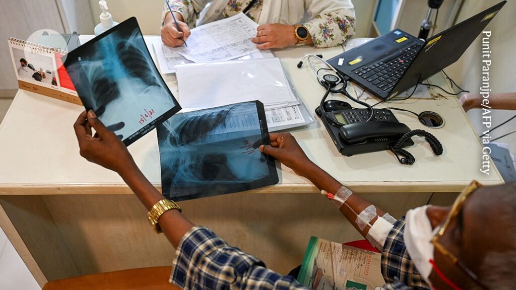 Tuberculosis Treatment Advances: Preventing Drug Resistance from Reversing Progress